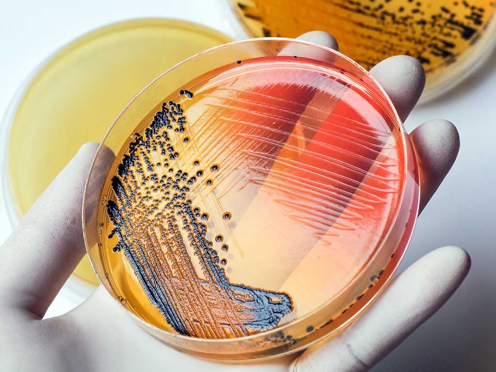 [IMG] bacterial-colonies-lab-120956638
