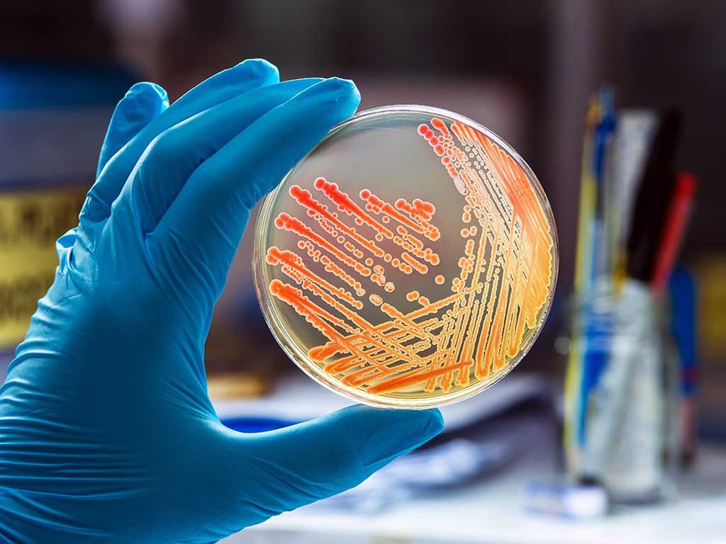 [IMG] bacterial-colonies-lab-130824738